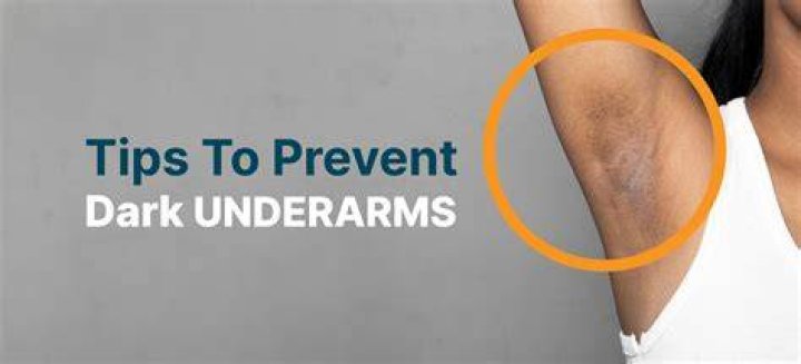 Can deodorant cause dark armpits?