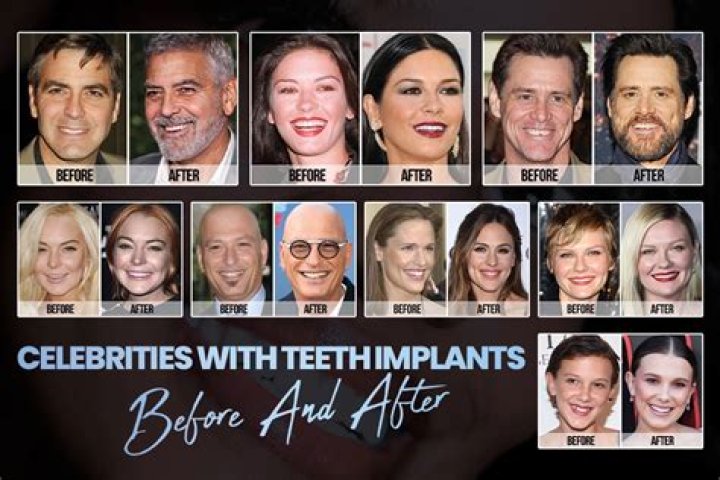 celebrity teeth header