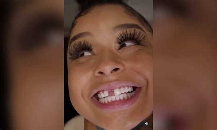 Chrisean Rock’s Missing Tooth: What Really Happened