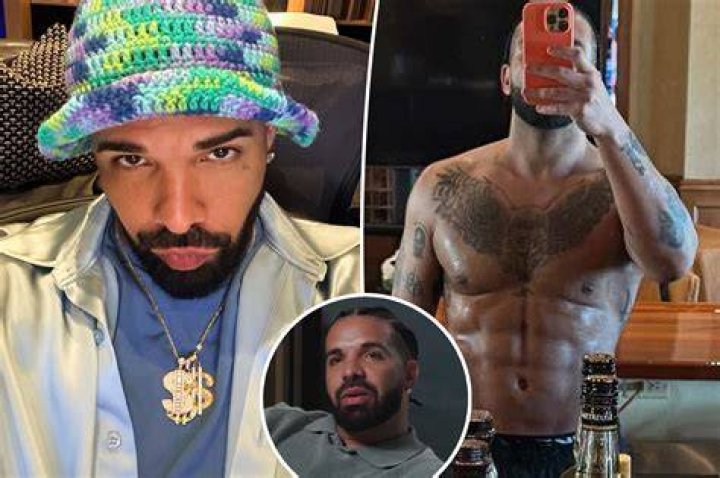 Did Drake Get A BBL: Surgery Rumors 2024