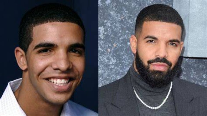 Did Drake Get A BBL