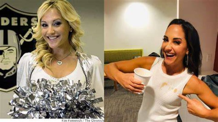 Here The Real Reason Why Emily Compagno Got Plastic Surgery