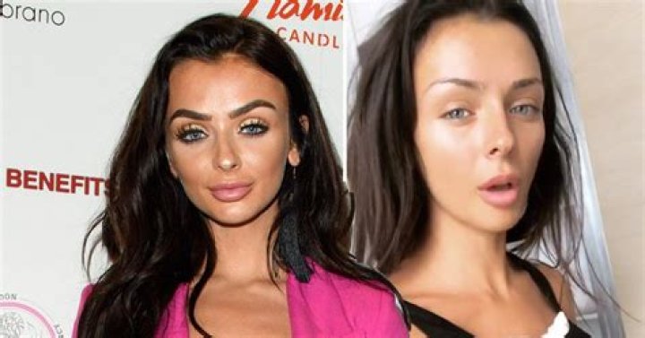 Kady McDermott Surgery