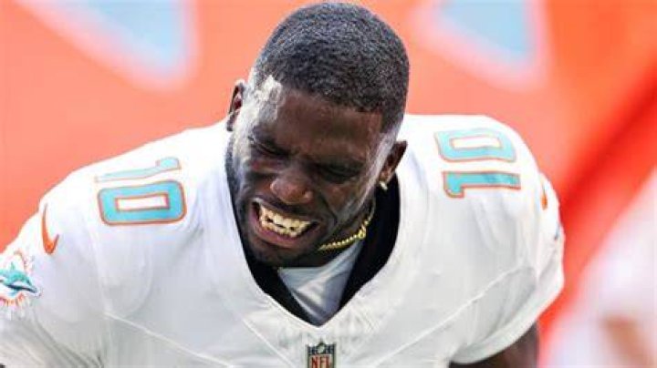 Tyreek Hill's pet Heaven and Sky