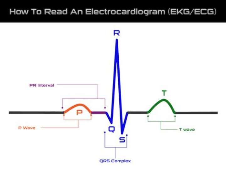What does an ECG measure quizlet?