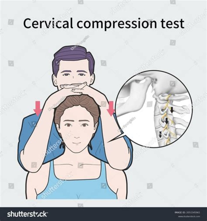 What is the cervical compression test?