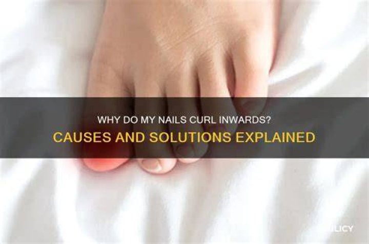 Why do my toenails curl inwards at sides?